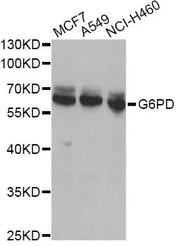 Polyclonal Rabbit anti-Human G6PD Antibody (IF, WB)