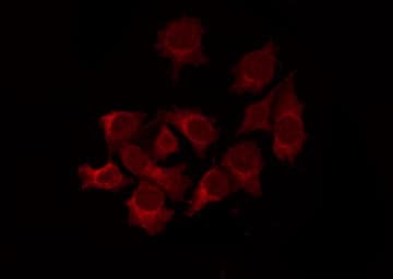 BCL2L1 / BCL-XL Antibody (phospho-Ser62)