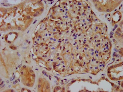 Polyclonal Rabbit anti-Human XIRP2 Antibody (IHC)