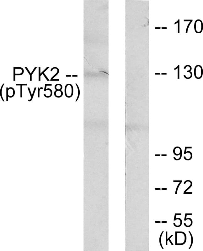 Polyclonal Rabbit anti-Human PTK2B / PYK2 Antibody (phospho-Tyr580, IHC, WB)