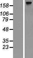 DOCK8 Protein (Over-Expression Lysate Myc-DDK (Flag))