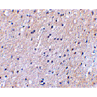 SLC9A1 / NHE1 Antibody