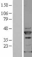 MAPK13 / p38delta Protein (Over-Expression Lysate Myc-DDK (Flag))