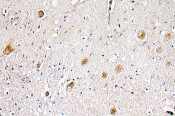 Polyclonal Rabbit anti-Human FGF1 / Acidic FGF Antibody (aa7-56, IHC)