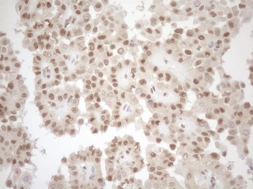 MGMT Antibody (clone OTI4F9)