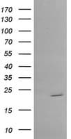 Monoclonal Mouse anti-Human RAB30 Antibody (clone OTI4B10, WB)