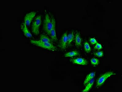 Polyclonal Rabbit anti-Human FARP1 / CDEP Antibody