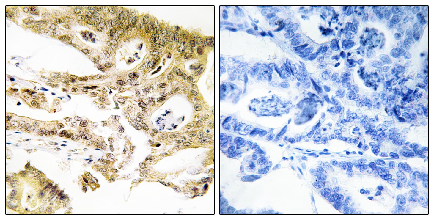 MED23 / SUR2 Antibody (aa1-50)