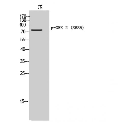 ADRBK1 / GRK2 Antibody (620-700 aa)