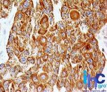 Monoclonal Mouse anti-Human TLR2 Antibody (clone 67N8F8, aa227-398, IHC, WB)
