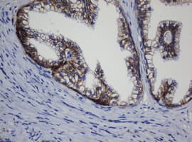 CDH1 / E Cadherin Antibody (clone OTI1B11)