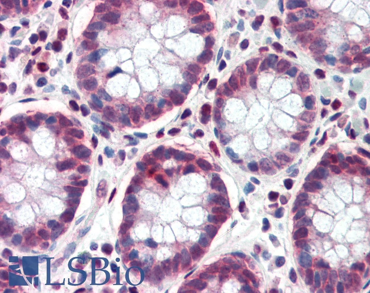TCF7L1 / TCF-3 Antibody (aa35-84)