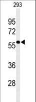 EXOC3L2 Antibody (aa54-83)
