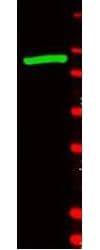 Polyclonal Rabbit anti-E. coli Beta Galactosidase Antibody (IHC, IF, WB)
