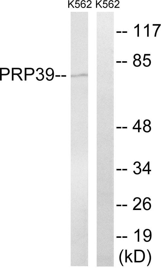 Polyclonal Rabbit anti-Human PRPF39 Antibody (WB)