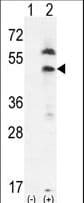 Polyclonal Rabbit anti-Human PRLTS / PDGFRL Antibody (aa328-357, IHC, WB)