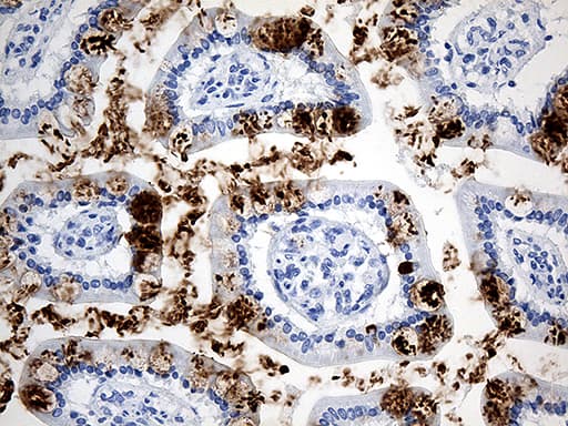 TFF1 / pS2 Antibody (aa25-84, clone OTI5H5)
