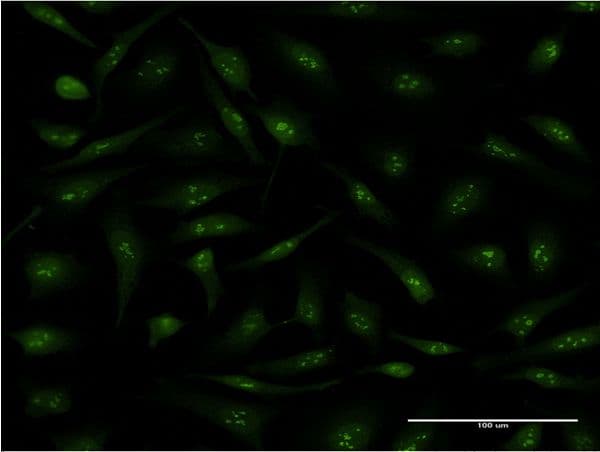 IHC-plus™ PPID / Cyclophilin D Antibody (clone 4C7)