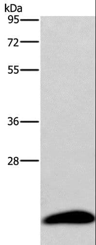 AURKAIP1 / AKIP Antibody