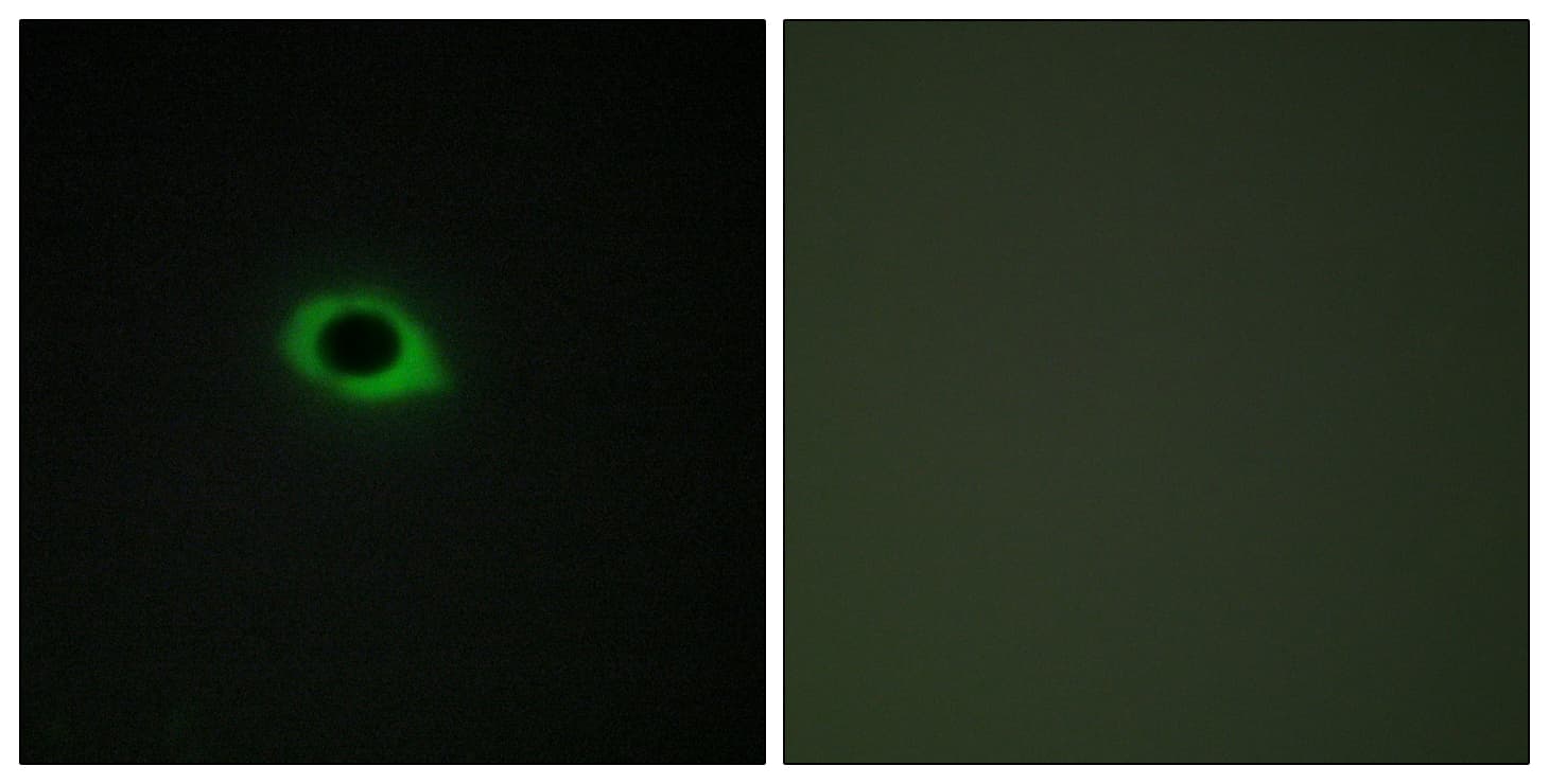 TNS3 / Tensin 3 Antibody (aa541-590)