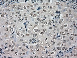 NEK6 Antibody (clone OTI5D7)