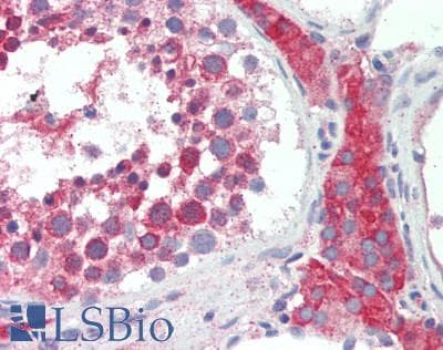 IHC-plus™ FDFT1 / Squalene Synthase Antibody (aa1-260)