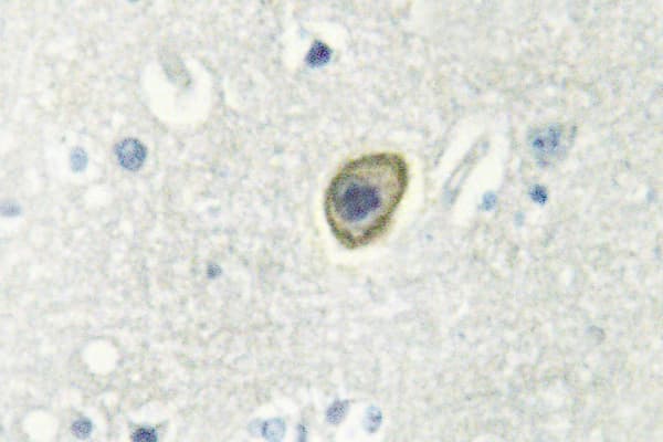 CSF1R / CD115 / FMS Antibody (Asn805)
