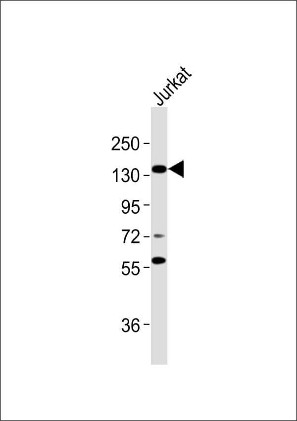 Polyclonal Rabbit anti-Human RBL2 / RB2 p130 Antibody (WB)