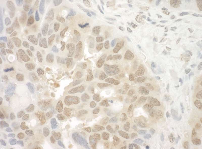 Polyclonal Rabbit anti-Human EYA4 Antibody (aa100-150, IHC)