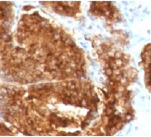 Monoclonal Mouse anti-Human TAG-72 Antibody (clone TAGP-4, IHC, IF)