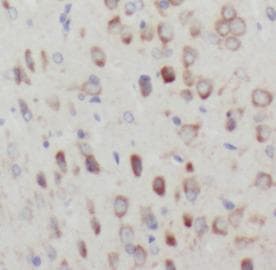 EPHA2 / EPH Receptor A2 Antibody