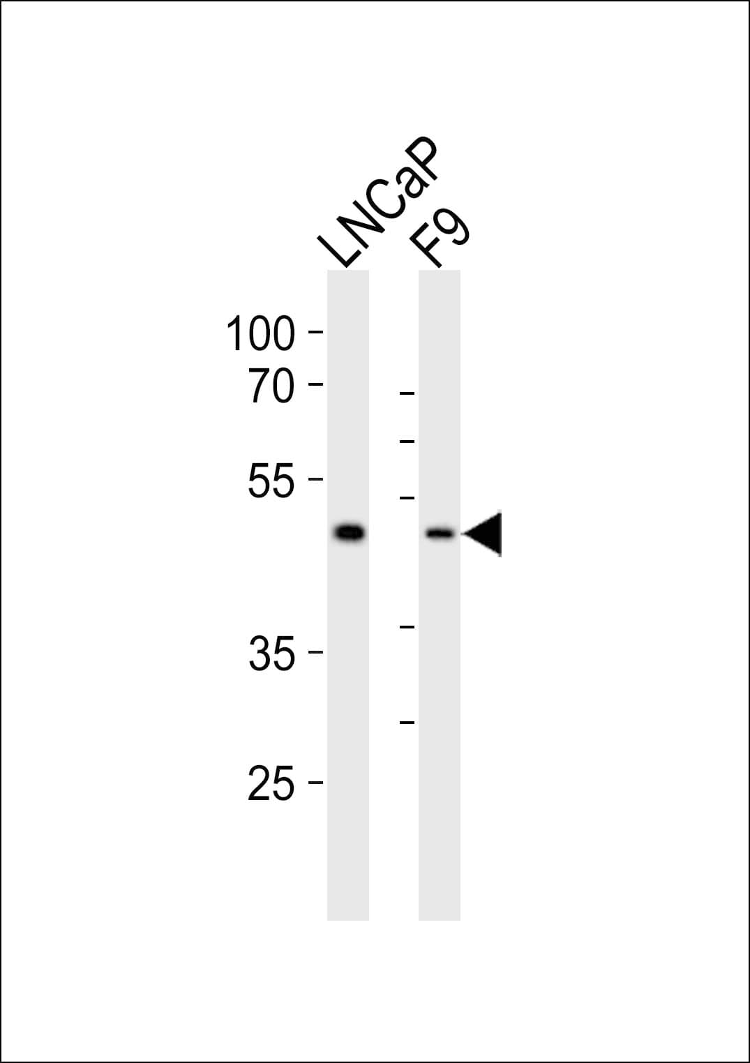 SOX17 Antibody (aa376-409)
