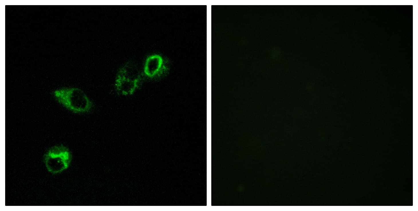 ACKR4 / CCRL1 / CCR11 Antibody (aa291-340)
