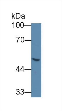 IHC-plus™ GLA / Alpha Galactosidase Antibody (aa81-429)
