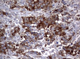 PIK3C2A Antibody (aa230-560, clone OTI2E4)