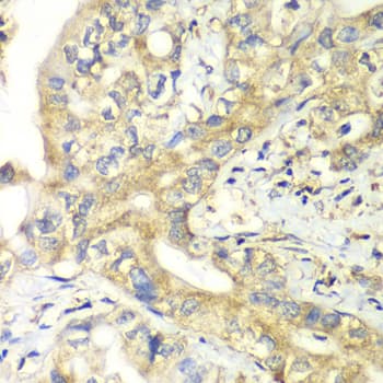Polyclonal Rabbit anti-Human TIMM17A / TIM17 Antibody (IHC, IF, WB)