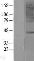 CCR6 Protein (Over-Expression Lysate Myc-DDK (Flag))