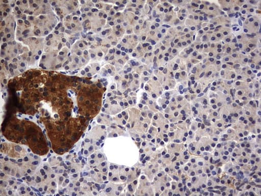 CSNK1G2 / CKI-Gamma 2 Antibody (aa163-415, clone OTI4H3)