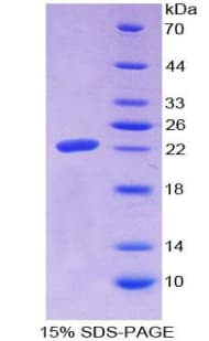 Human MAGP / MFAP2 Protein (Recombinant His-T7)