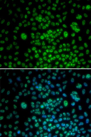 Polyclonal Rabbit anti-Human MAX Antibody (IHC, IF, WB)