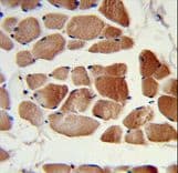 TIP49 / RUVBL1 Antibody