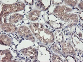 TMEFF2 Antibody (clone OTI1B4)