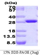Aequorea victoria GFP Protein (Recombinant)