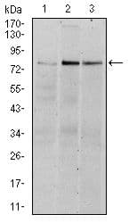 RPS6KA3 / RSK2 Antibody (clone 40000000000)