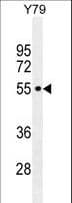 CCDC97 Antibody (aa241-269)