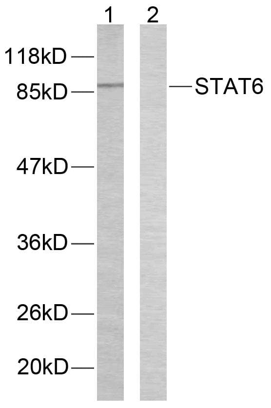 STAT6 Antibody (p645)