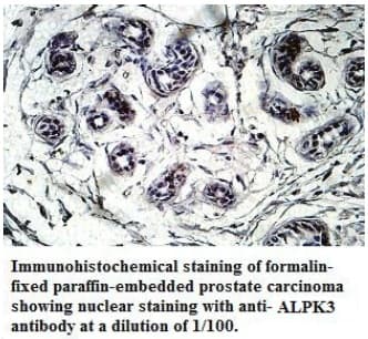 Polyclonal Rabbit anti-Human ALPK3 Antibody (C-Terminus, IHC)