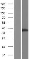 C11orf65 Protein (Over-Expression Lysate Myc-DDK (Flag))