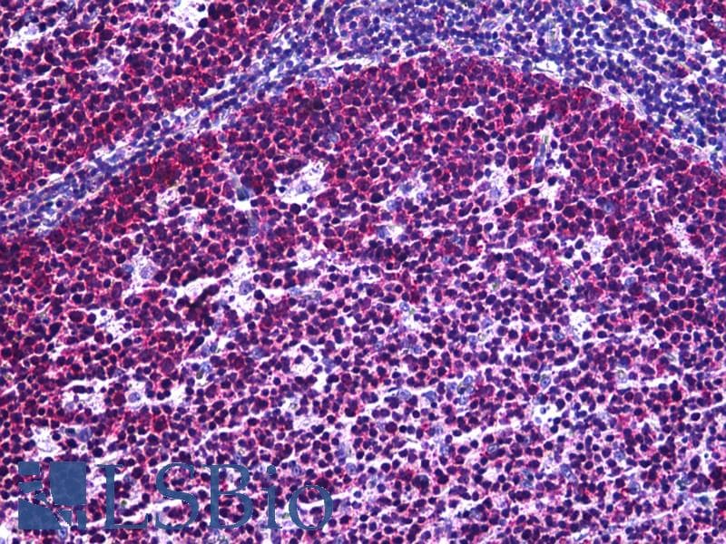 IHC-plus™ Polyclonal Rabbit anti-Human IGF2R / CD222 Antibody (aa2441-2490, IHC, IF)