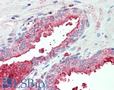 IHC-plus™ Polyclonal Rabbit anti-Human DPP4 / CD26 Antibody (Internal, IHC)